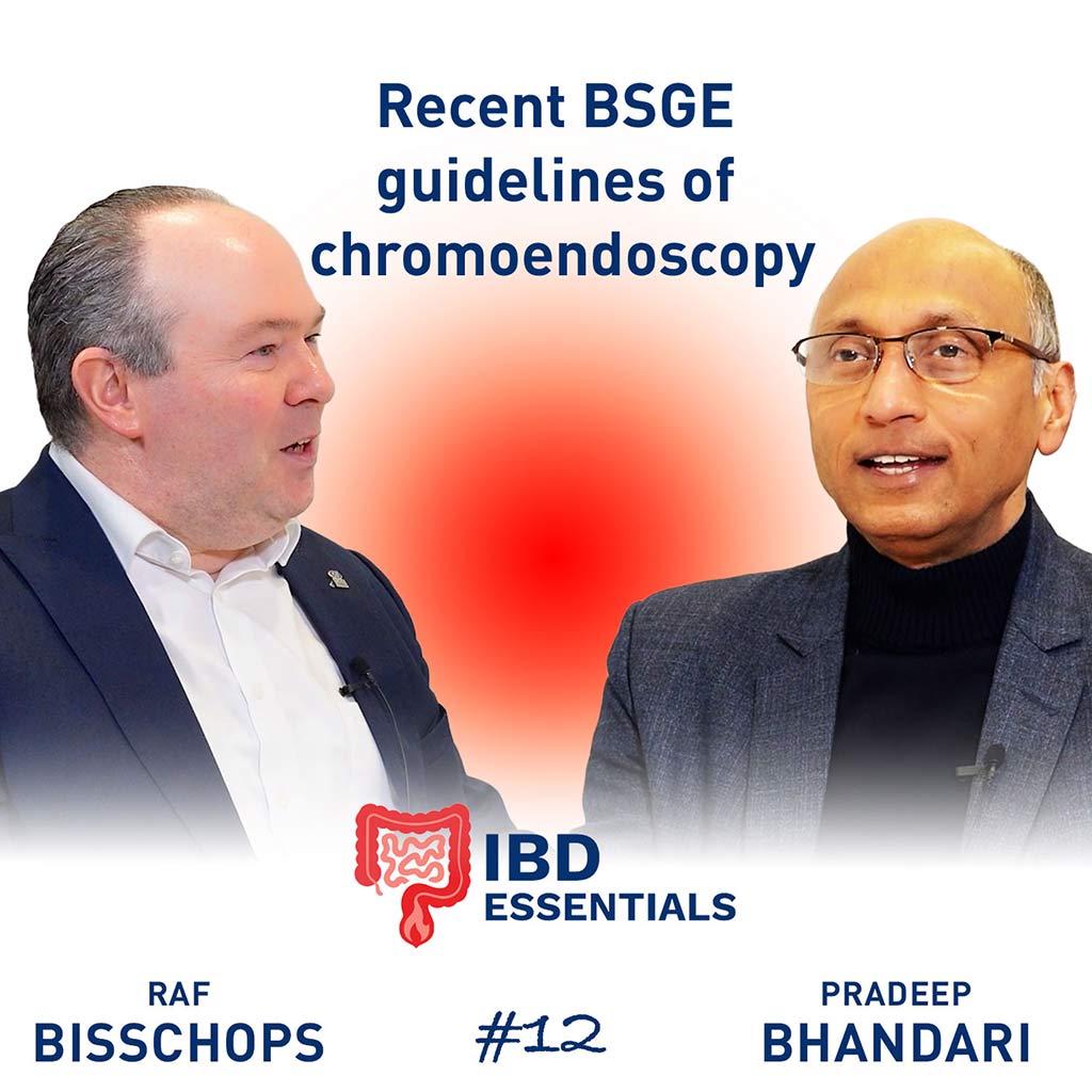 Recent BSG guidelines of chromoendoscopy in IBD