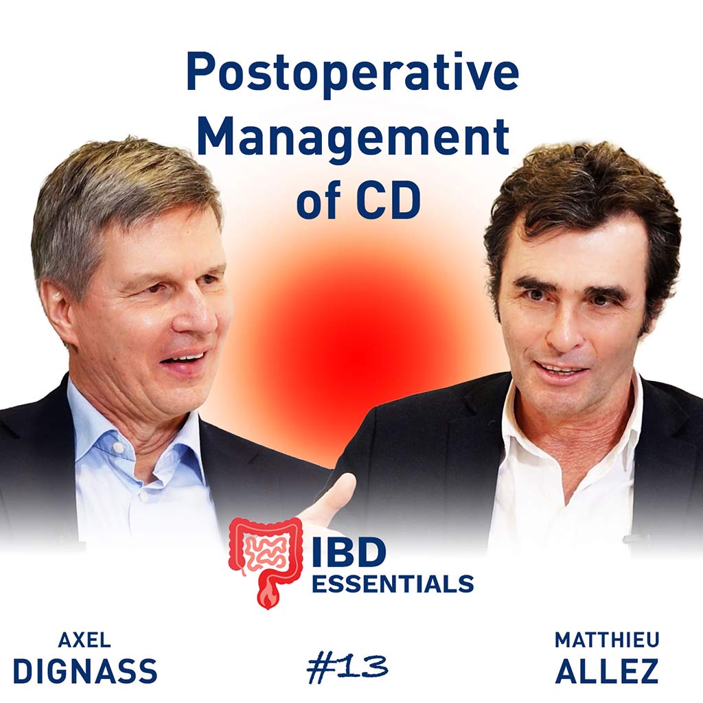 Management of postoperative Crohn’s disease